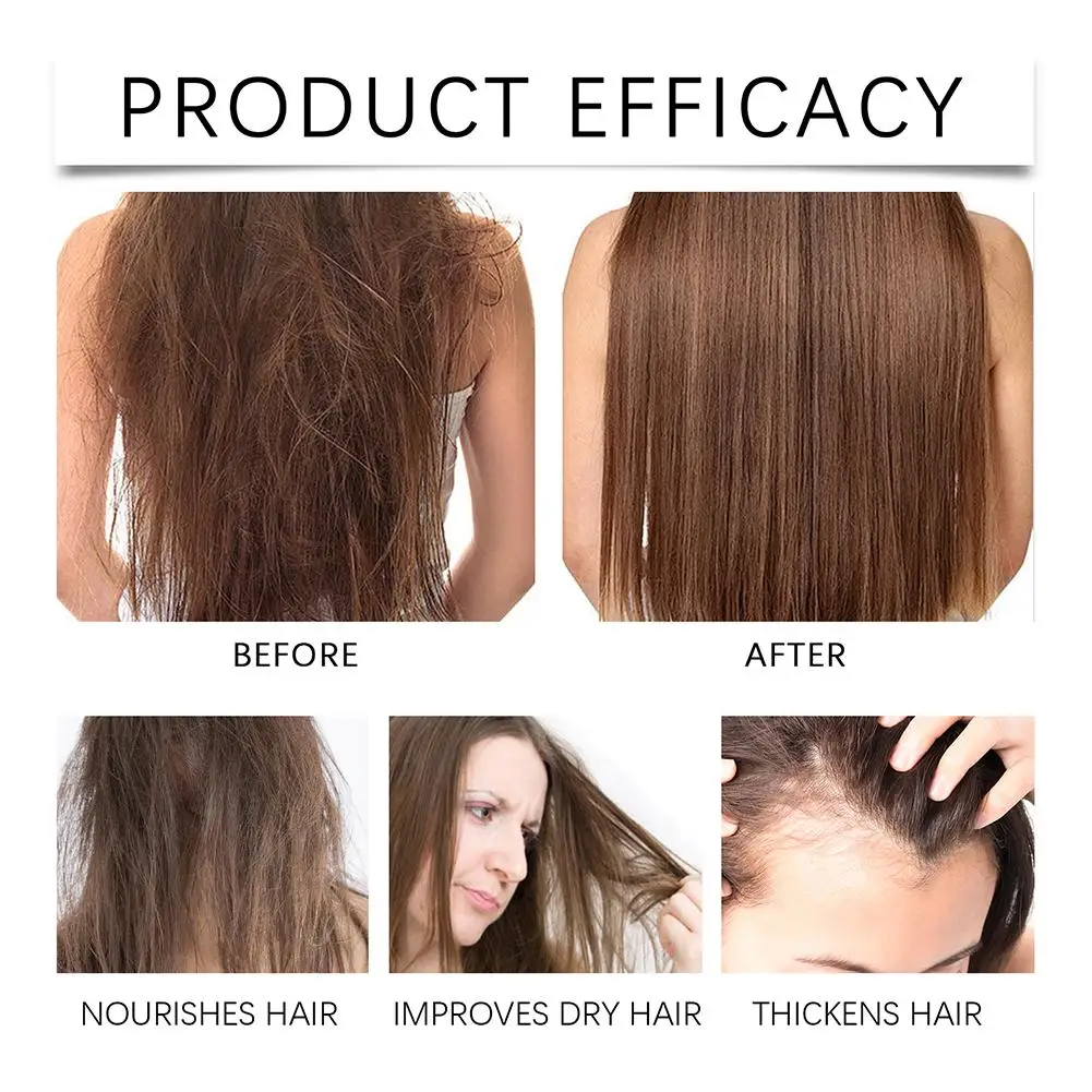 Aceite Anticaida Capilar de Batana Orgánico Tratamiento Natural Fortalece la Raíz del Cabello - Imagen 3